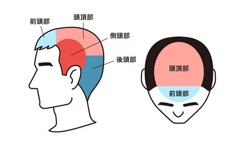 頭頂頭痛 原因|頭頂部の頭痛：医師が考える原因と対処法｜症状辞典 